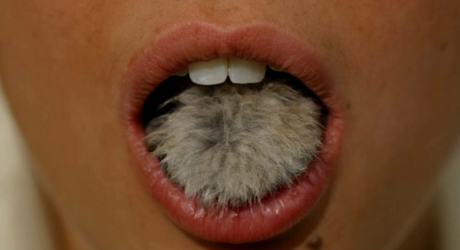 La Belle et la Bête